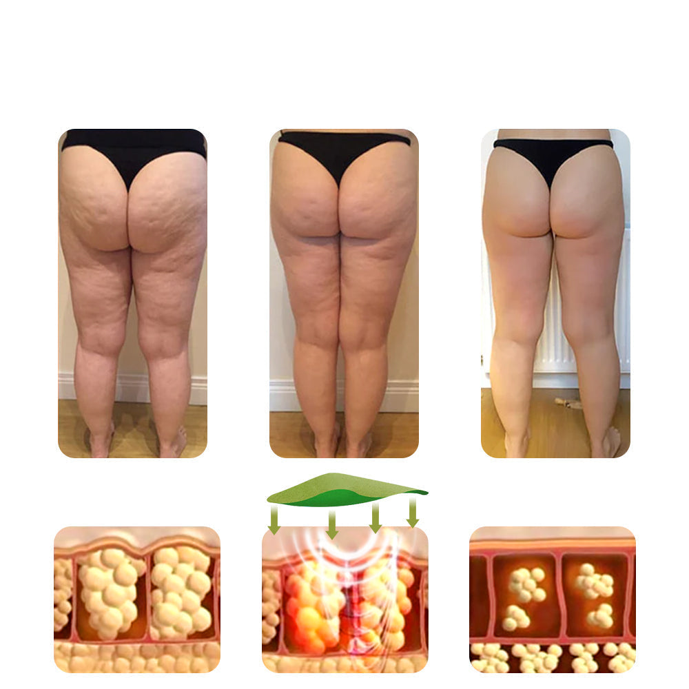 Cellulite Pleisters Body Care Gladdere Strakkere Huid