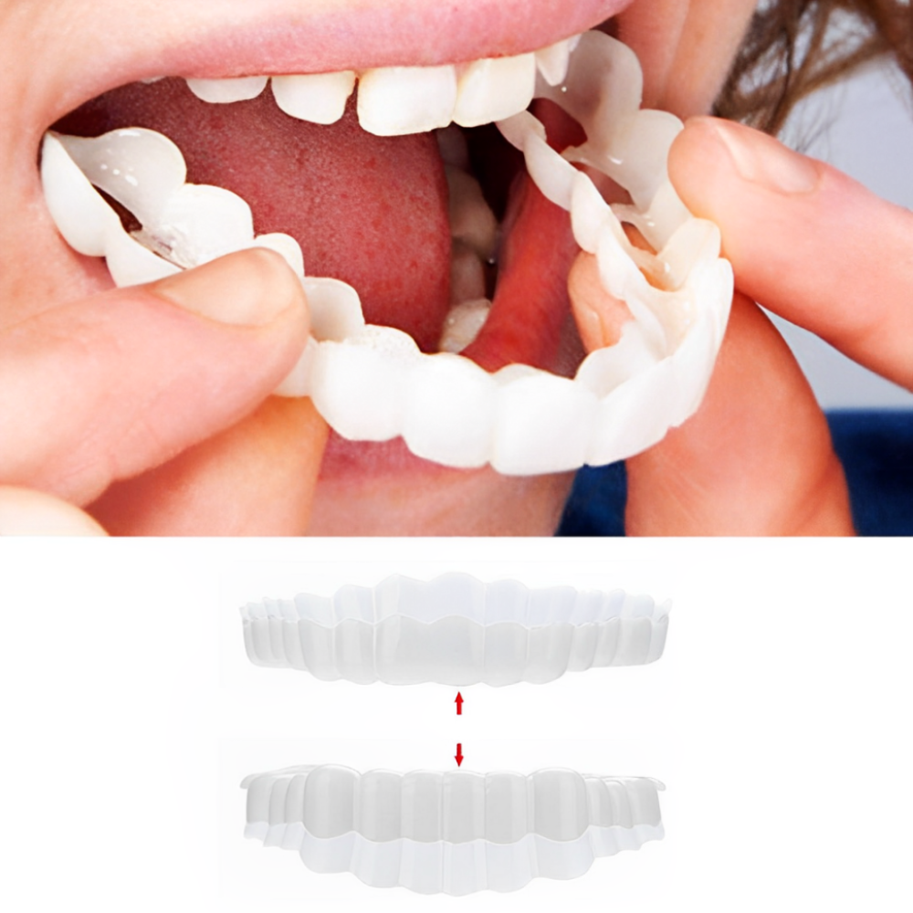 Instant Smile Veneers Upper Lower Dental Covers for Flawless Teeth 0
